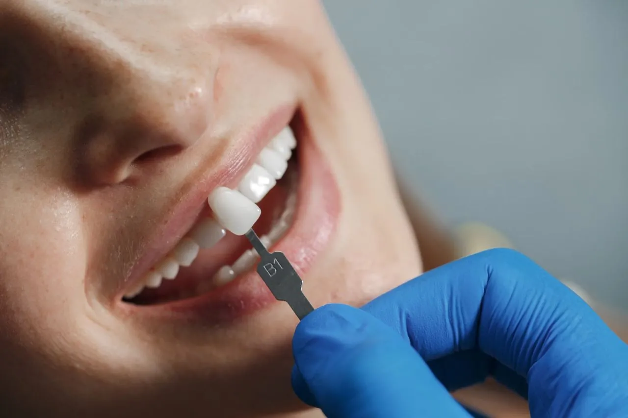 Dentist matching a crown shade to a patient's teeth