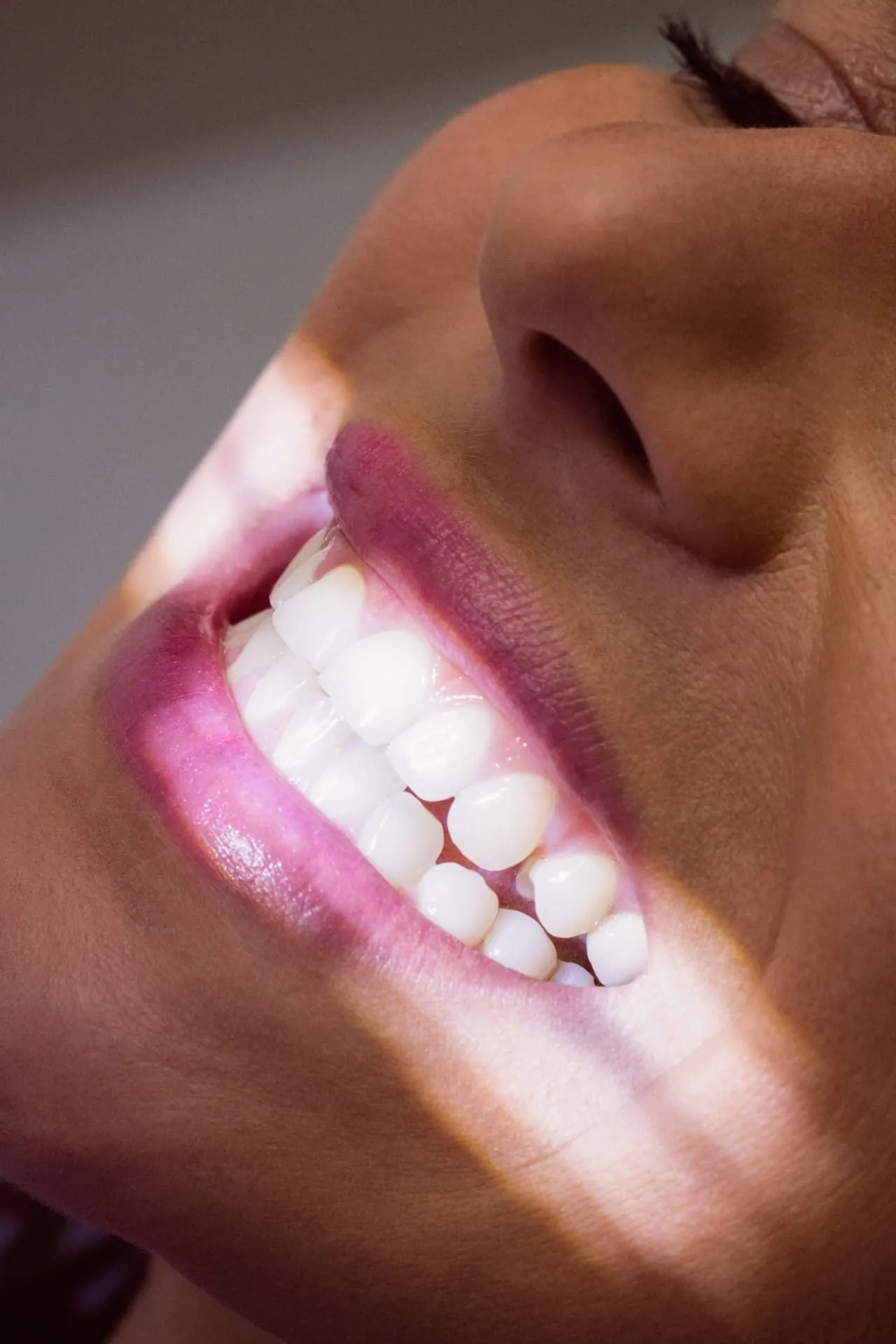 Close-up of a bright white smile