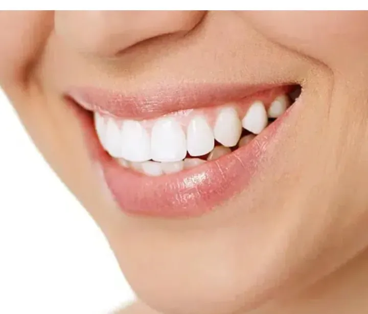 Zoom Teeth Whitening